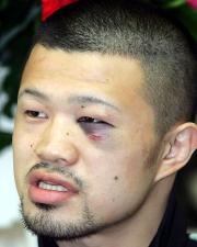 左目を腫らし一夜明け会見する小堀祐介(撮影・中村誠慈)