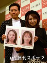 整形前と後写真を持つ安達有里と執刀した保志名勝医師（撮影・村上幸将）