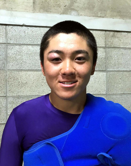 右目の上が腫れた状況でも2回無安打無失点と好救援した滝川西の岩崎（撮影・永野高輔）