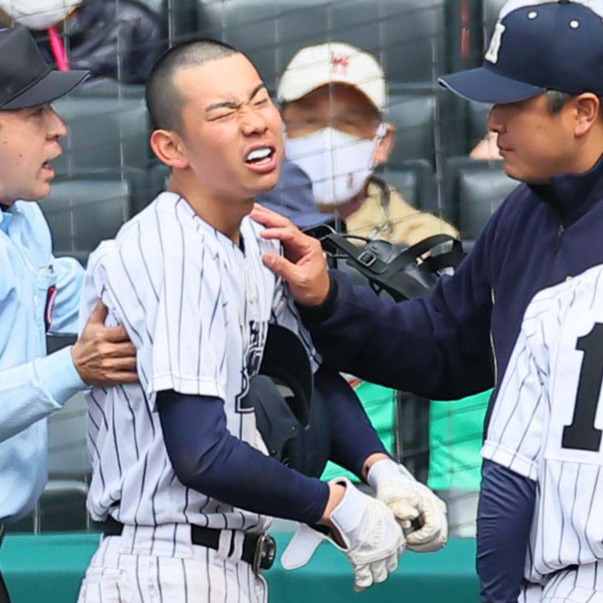 阿南光対豊川　8回表阿南光無死一、二塁、顔面付近に死球を受けた阿南光・井坂（左）を心配する高橋監督（撮影・上田博志）