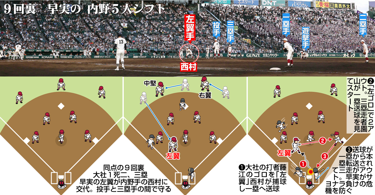 【イラスト】９回裏の早実「内野5人シフト」
