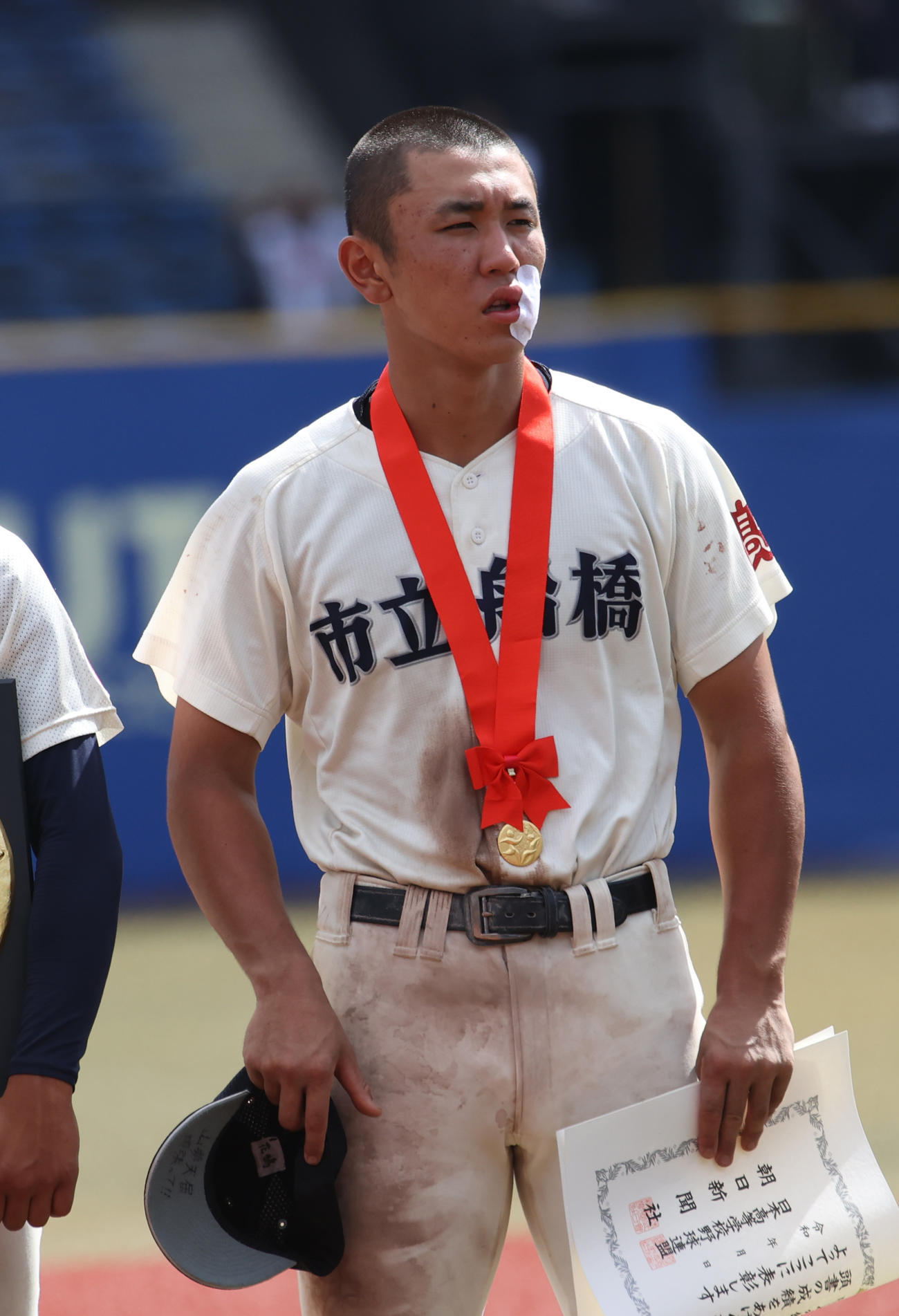八千代松陰対市船橋　試合で顔に死球を受けた市船橋・花嶋は治療して表彰式に出席した（撮影・柴田隆二）