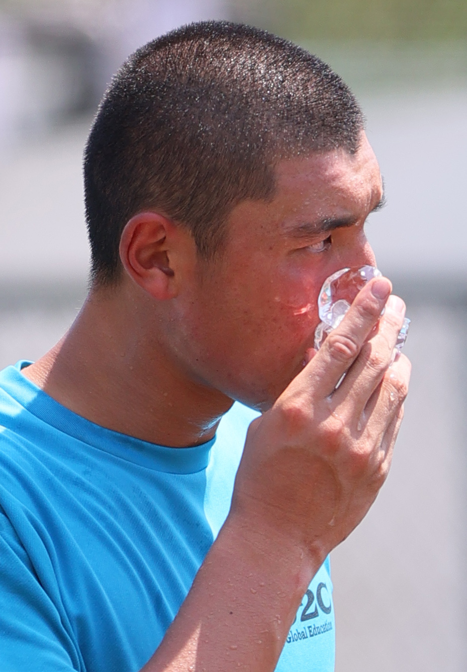 自打球が顔に当たり氷で冷やす山梨学院の菰田（撮影・上山淳一）