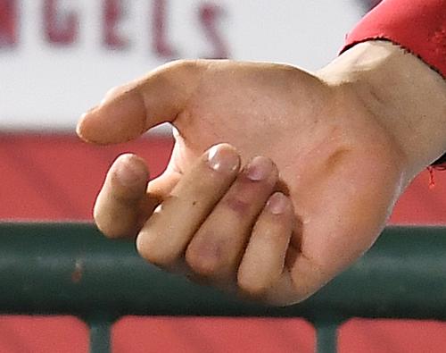 前夜に投球を受けたエンゼルス大谷の右手薬指は、赤く変色していた（撮影・菅敏）