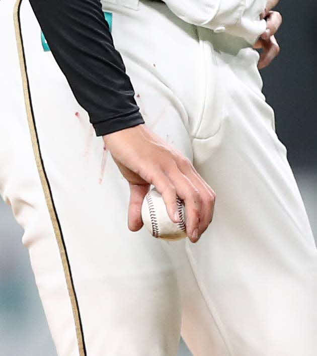 日本ハム対西武　3回表、右手薬指から出血する上沢（撮影・黒川智章）