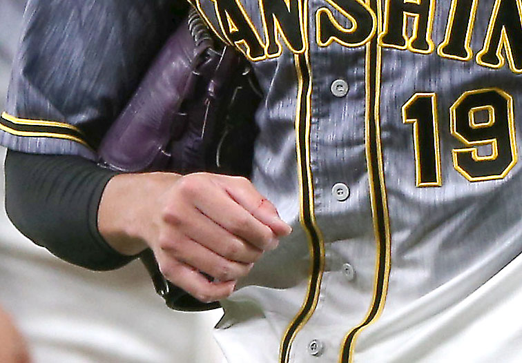 オリックス対阪神　1回裏オリックス無死、佐野を四球に出した藤浪（手前左）は右手が出血しベンチへ手当てに向かう（撮影・上山淳一）