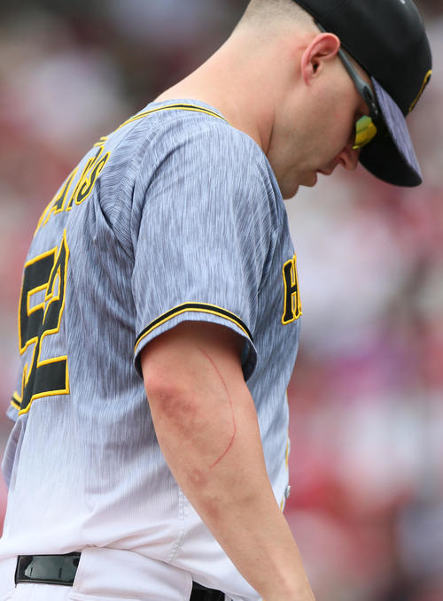 広島対阪神　5回の守備でサンズの右手には傷跡が残る（撮影・上山淳一）