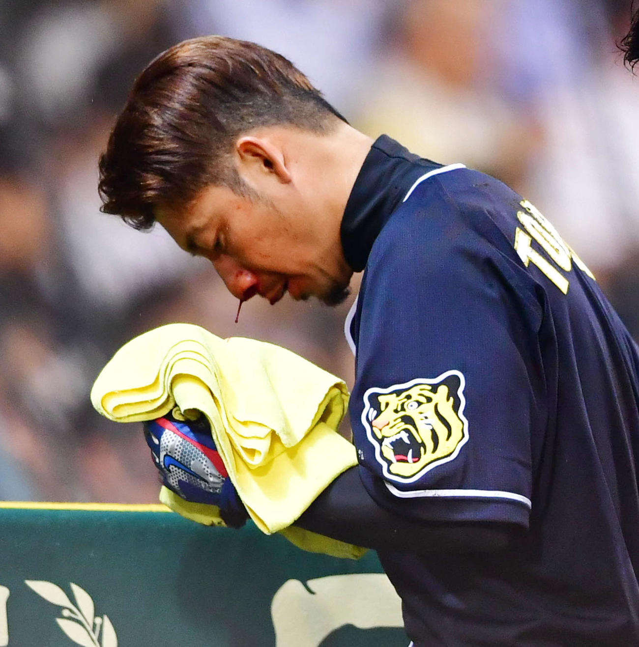 17年5月、巨人戦の5回裏1死三塁、巨人吉川光から顔面に死球を受け交代となる阪神鳥谷