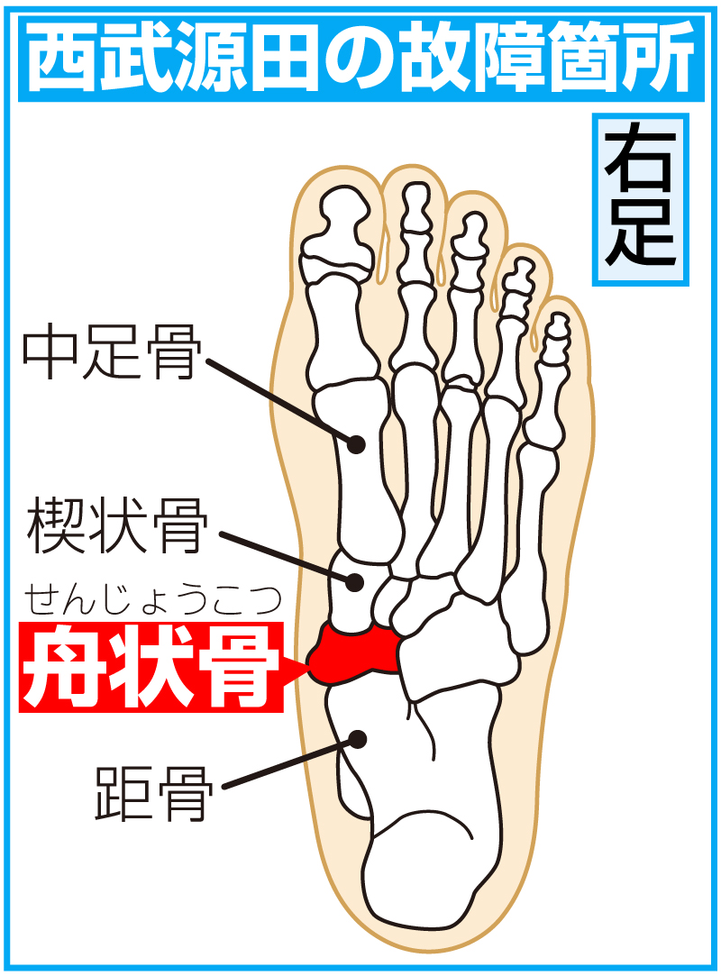 足舟状骨骨