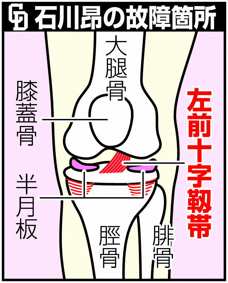 中日石川昂弥の故障箇所