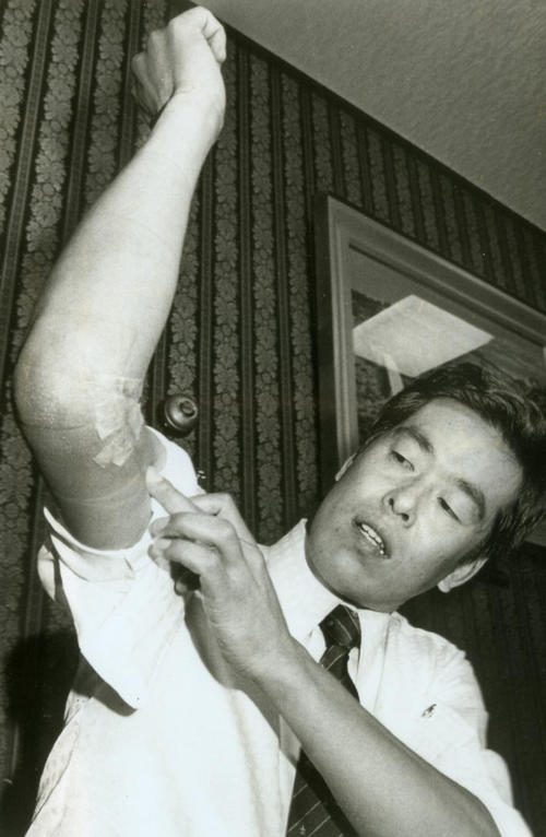 1983年9月16日　渡米してジョーブ博士による腱移植手術を受けたロッテ村田兆治