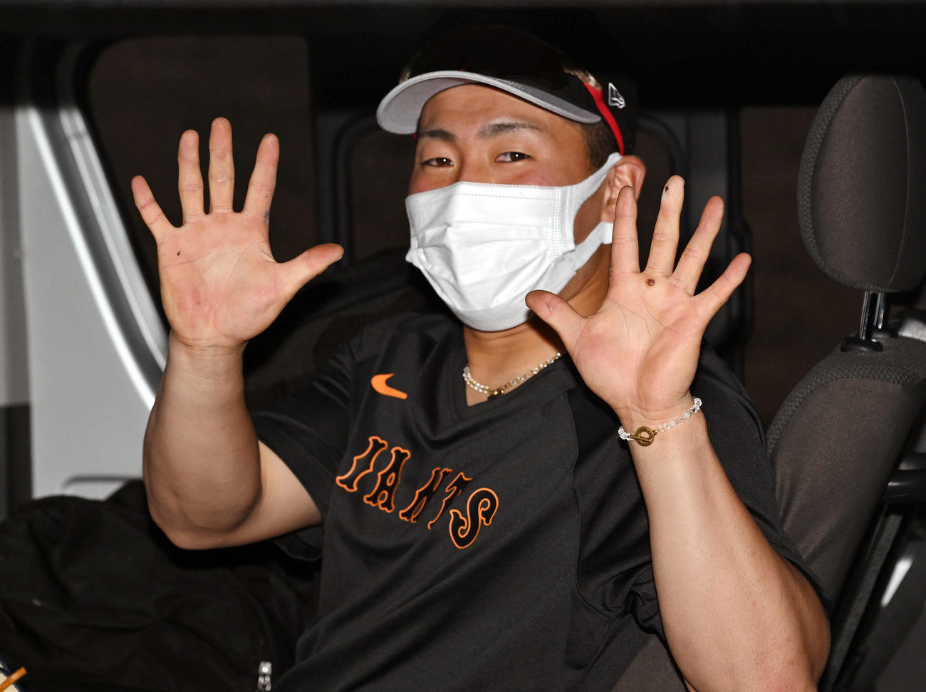 練習後、マメがつぶれ血豆になった手を見せる巨人ドラフト1位浅野（撮影・滝沢徹郎）