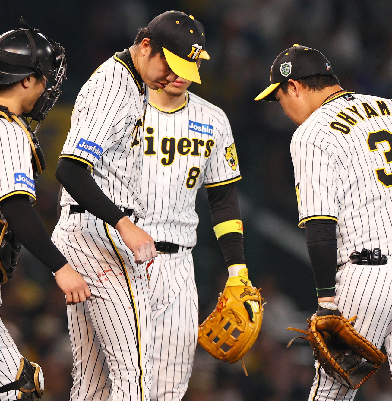 阪神対オリックス　2回表、右手が流血する阪神才木（左から2人目）（撮影・上山淳一）