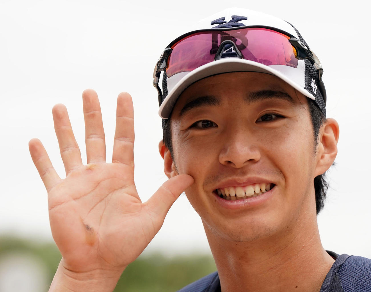 右手に出来たマメを見せるDeNAドラフト1位の度会（撮影・たえ見朱実）