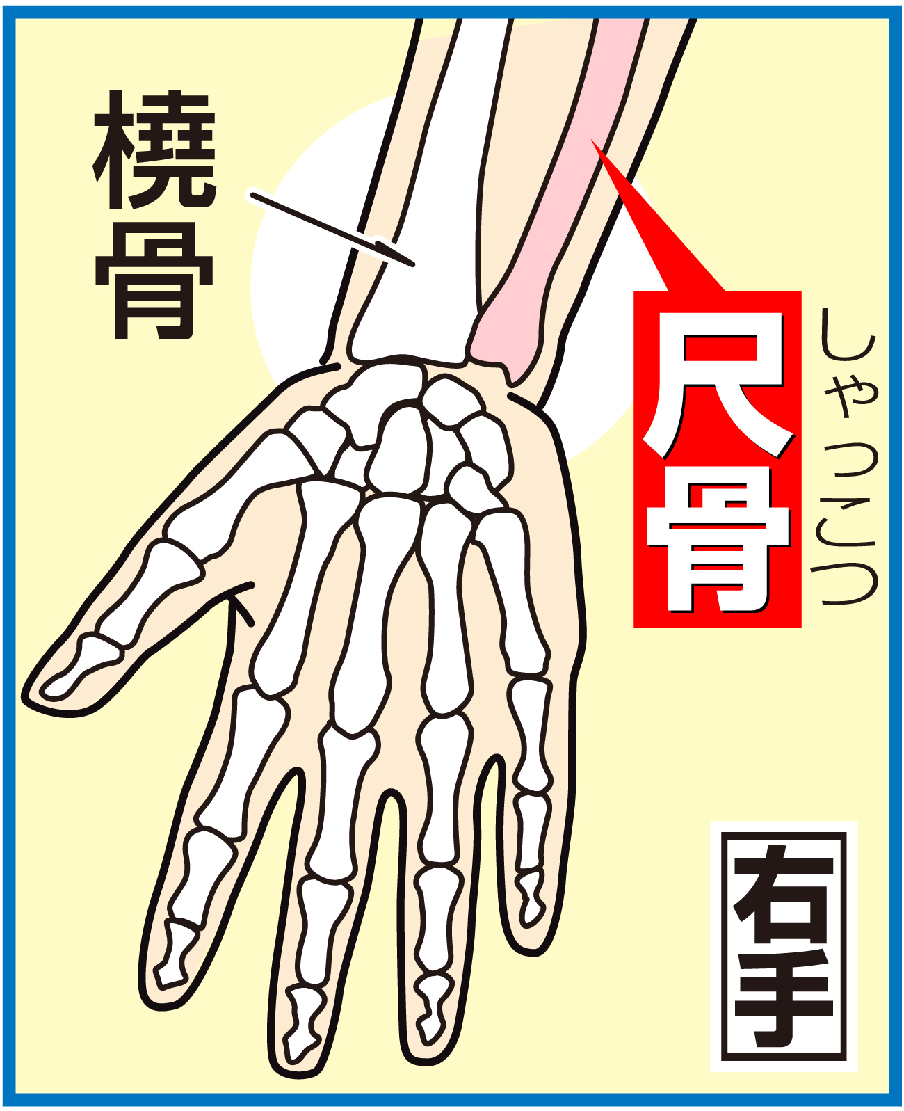 【イラスト】ＤｅＮＡ山本の骨折箇所・右手尺骨