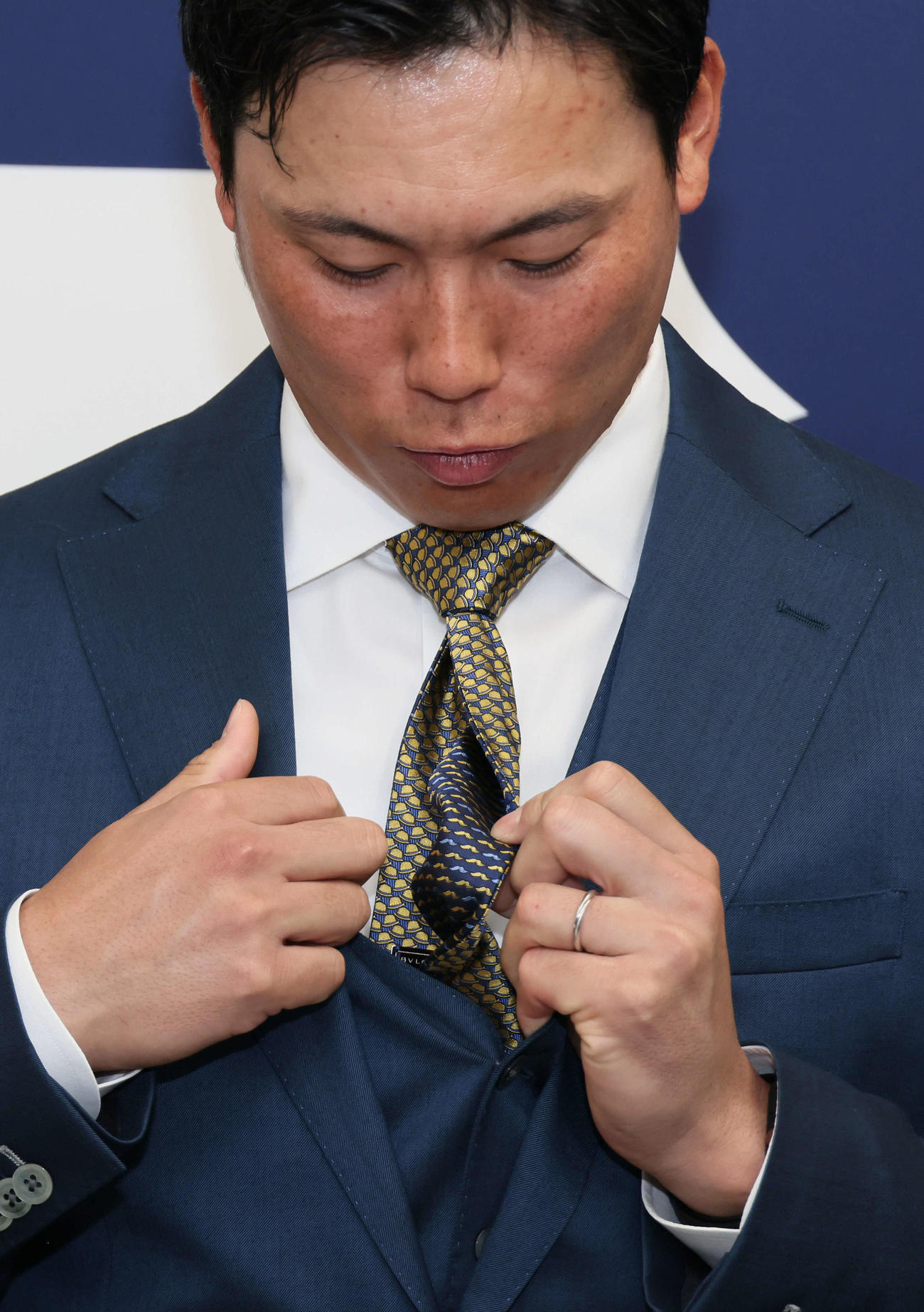 契約更改後の会見で、リバーシブルのネクタイを見せる広島栗林。年俸が下がったら裏側を、上がったら表側の金色と決めていた（撮影・加藤孝規）　