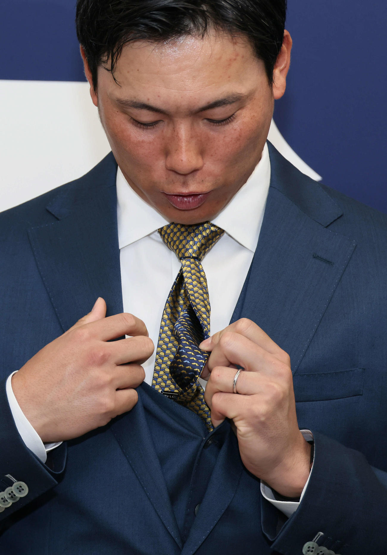 契約更改後の会見で、リバーシブルのネクタイを見せる広島栗林。年俸が下がったら裏側を、上がったら表側の金色と決めていた（撮影・加藤孝規）　
