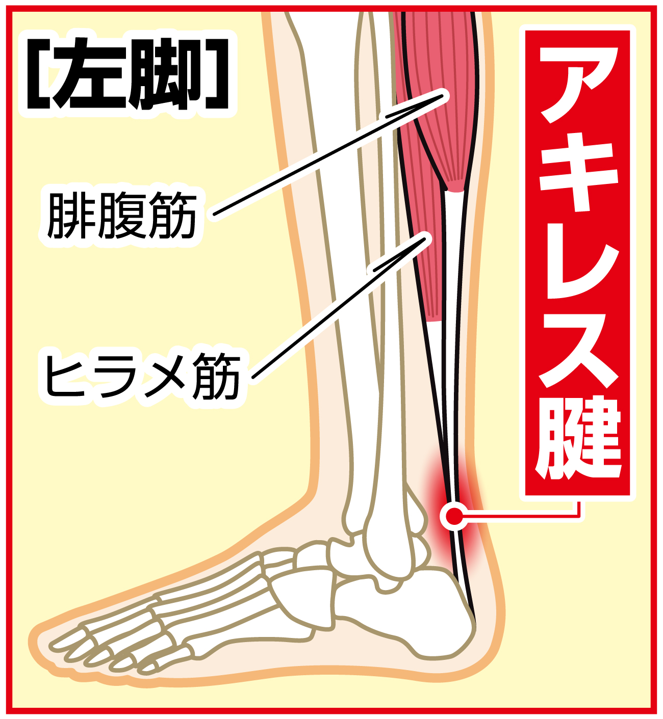 【イラスト】阪神石井の故障箇所　アキレス腱