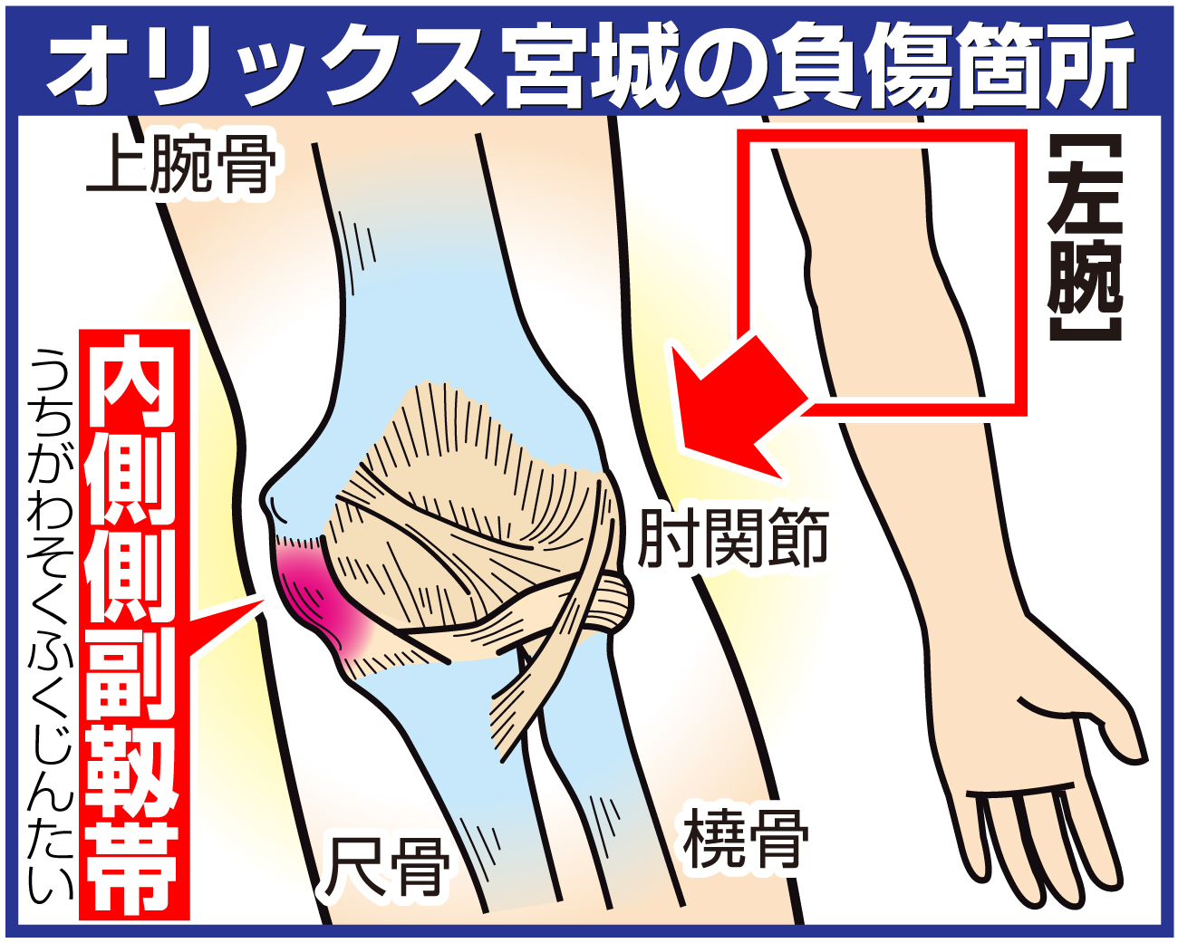 【イラスト】オリックス宮城の負傷箇所