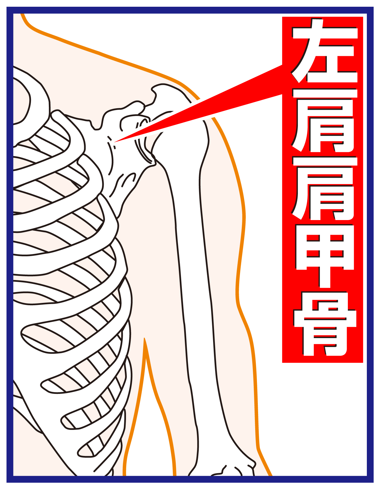【イラスト】ソフトバンク今宮の故障個所