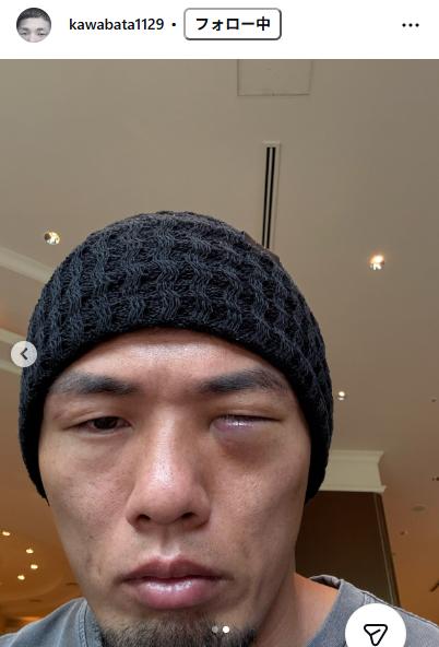 ドンマイ川端のインスタグラムから