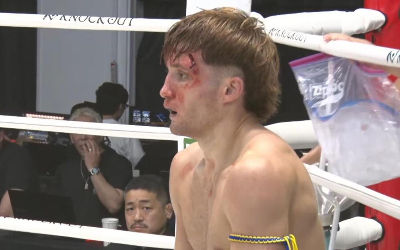 左目の上を深くカットしたユリアン（KNOCK OUT公式YouTubeから）