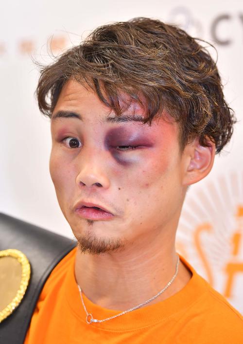 「こうすれば左目も開きますよ！」と茶目っ気たっぷりに目を見開くWBA世界ライトフライ級チャンピオン京口紘人（撮影・上田博志）