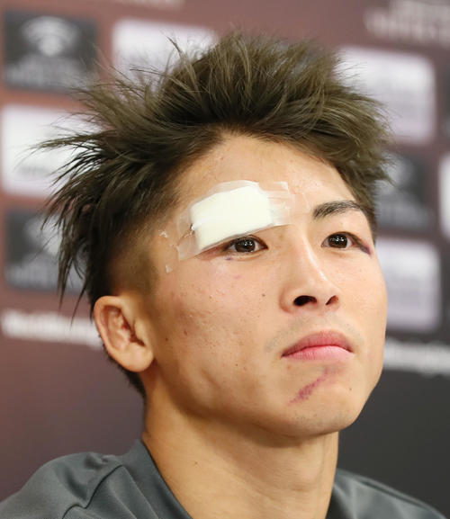 治療を終え、会見に臨む井上尚（撮影・足立雅史）