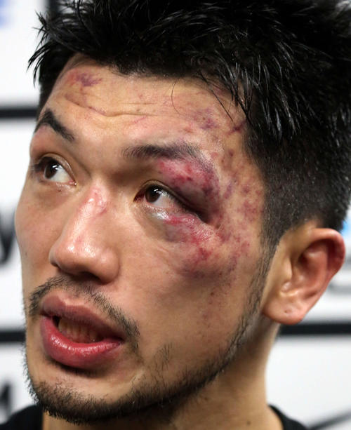 試合後、腫れた左目で会見を行う村田（撮影・狩俣裕三）
