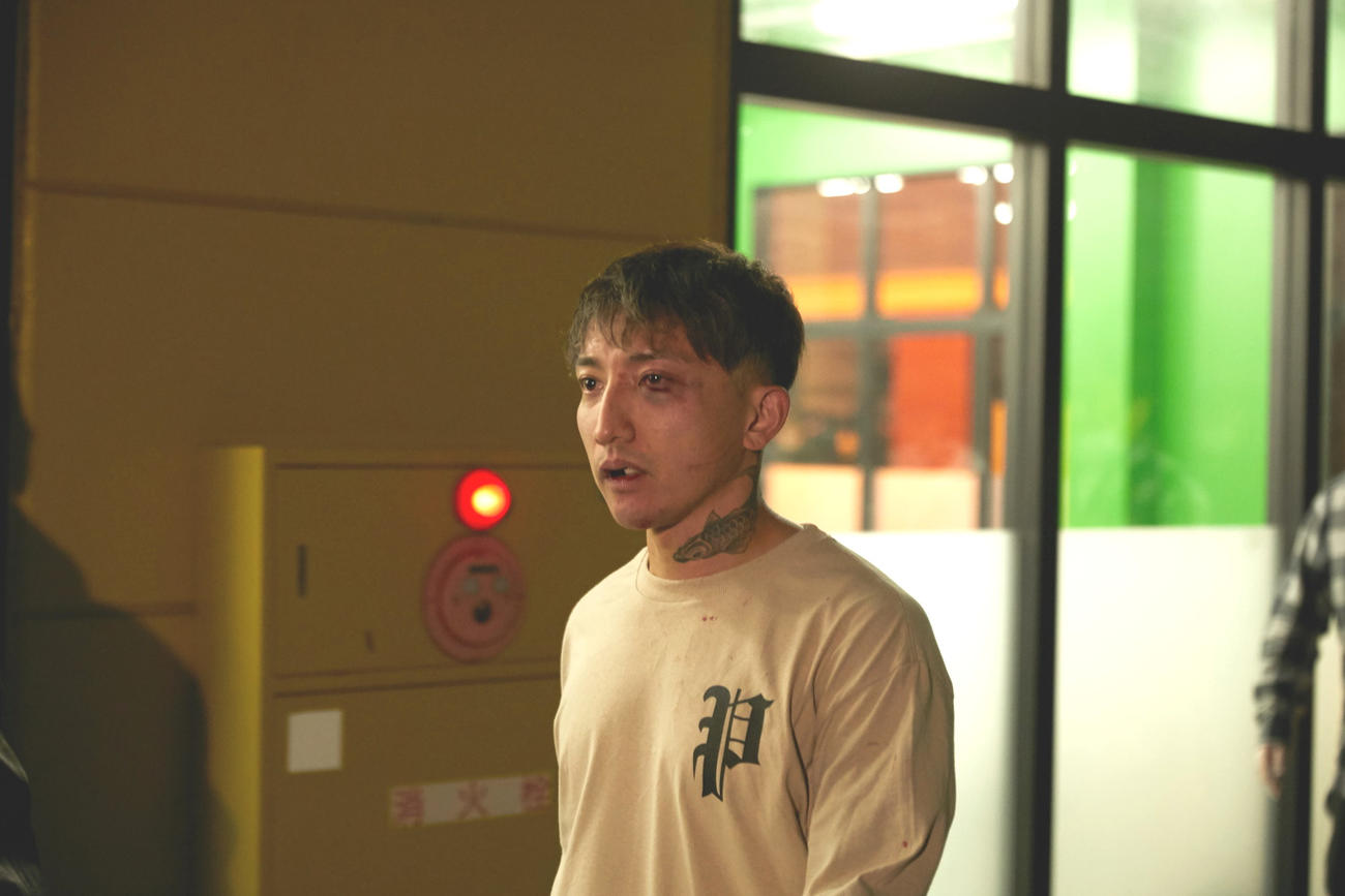 朝倉に敗れ、左目を大きく腫らした後藤（C）AbemaTV, Inc.
