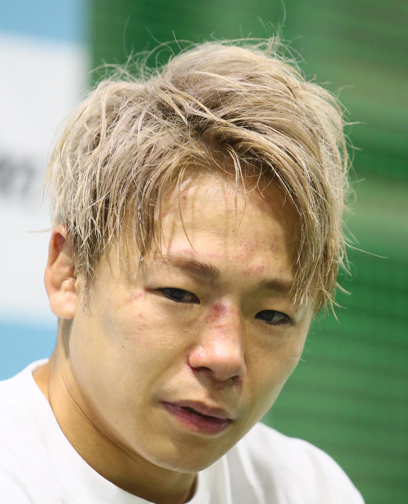 傷だらけの顔で試合を振り返る武尊（2022年6月19日撮影）