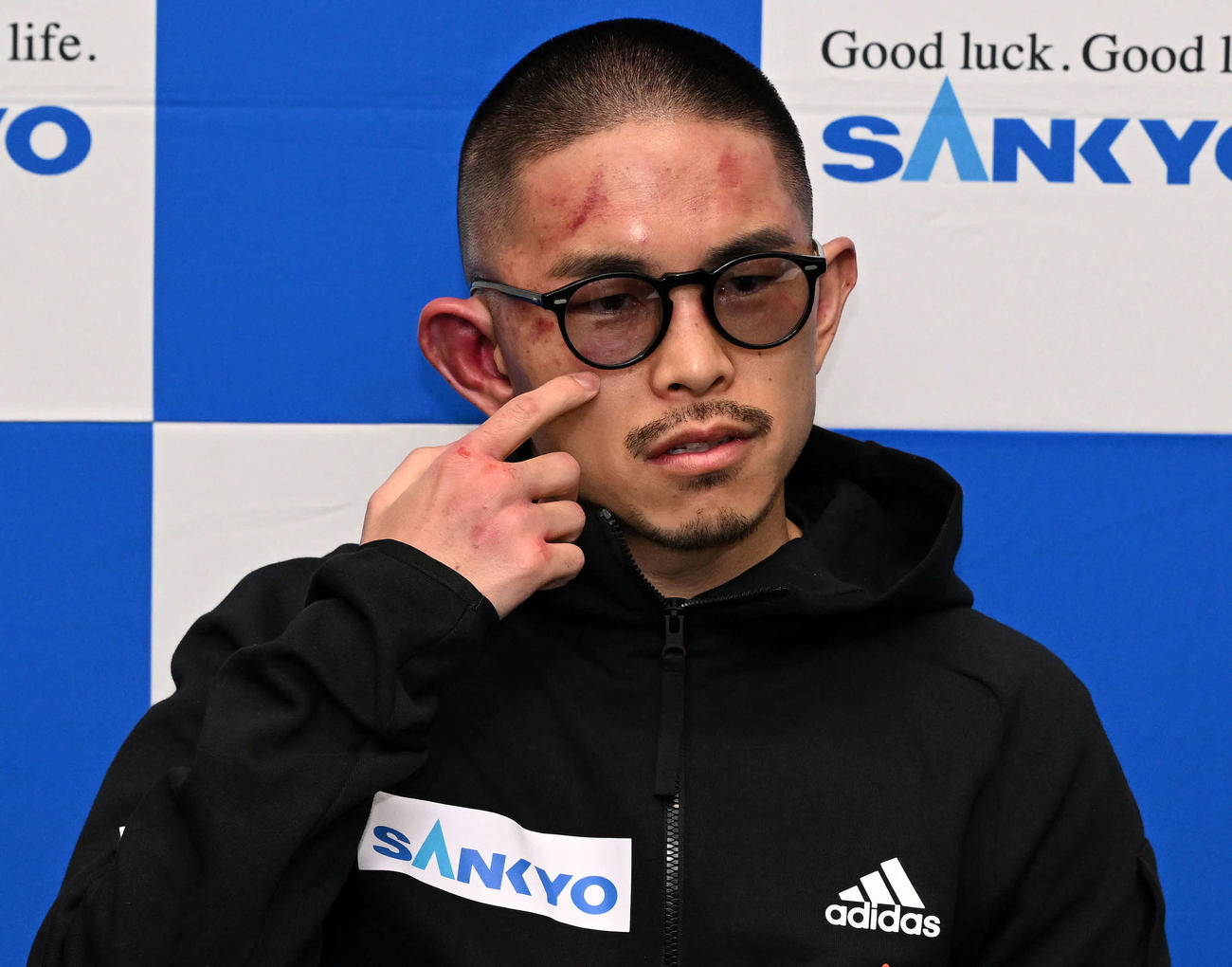 試合後、会見した井岡の顔には激闘の跡が残っていた（撮影・滝沢徹郎）