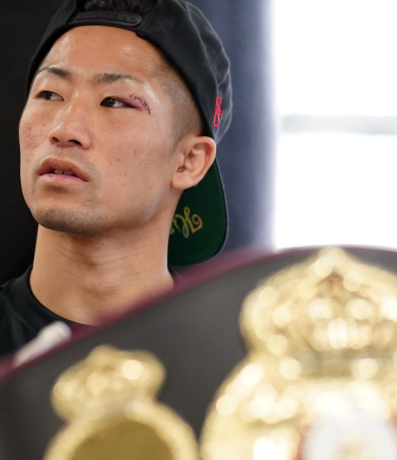 一夜明け会見で左まぶたを試合後に7針縫ったことを明かした井上（撮影・狩俣裕三）