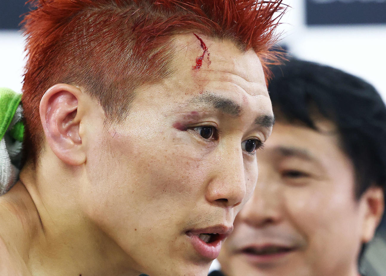 試合後会見を終え、報道陣に負傷した部分を見せる小国（撮影・河田真司）