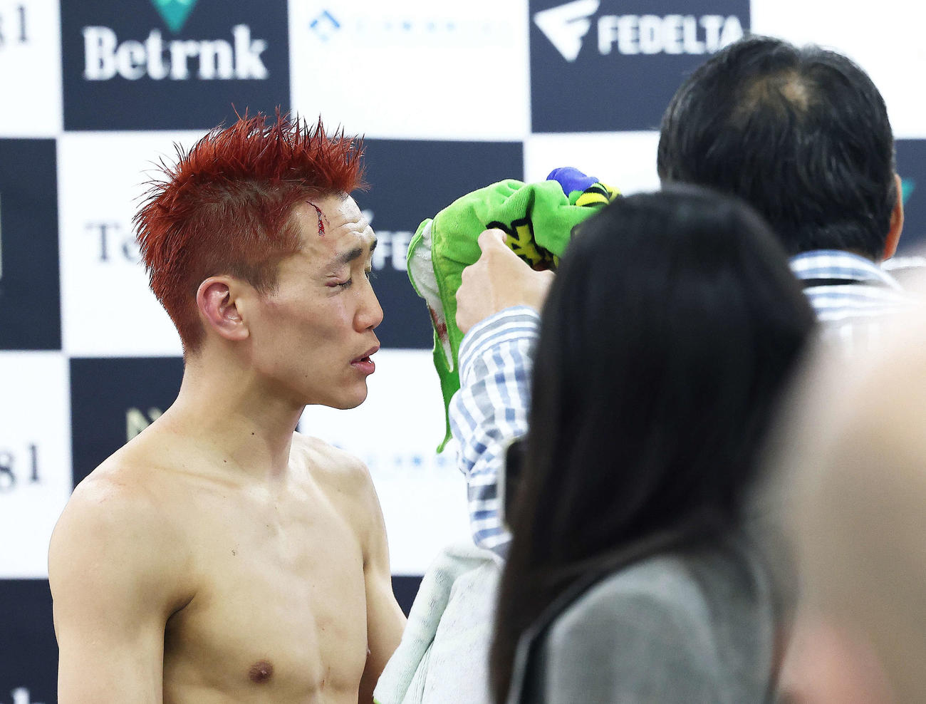 試合後会見を終え、報道陣に負傷した部分を見せる小国（撮影・河田真司）