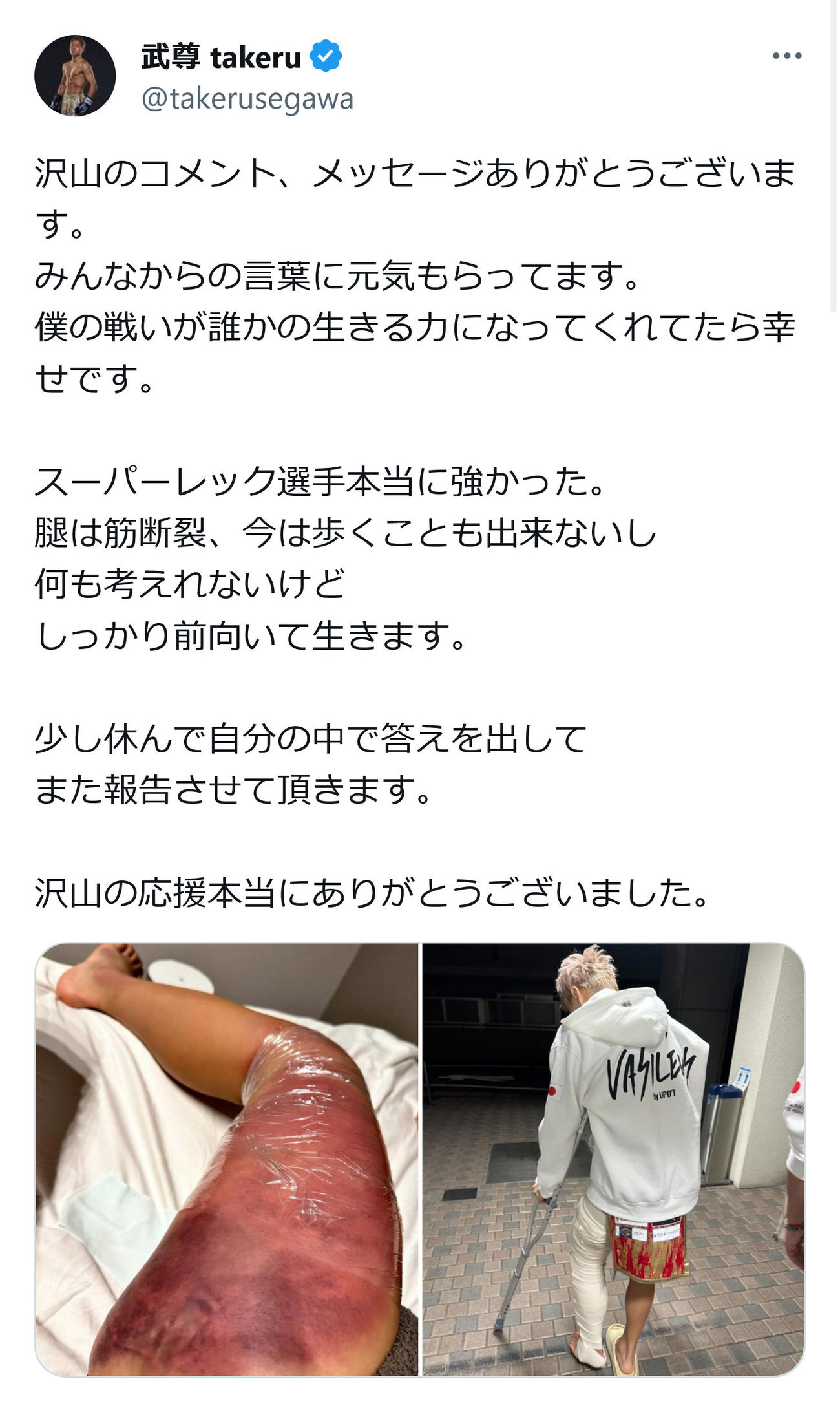 武尊のX（旧ツイッター）から