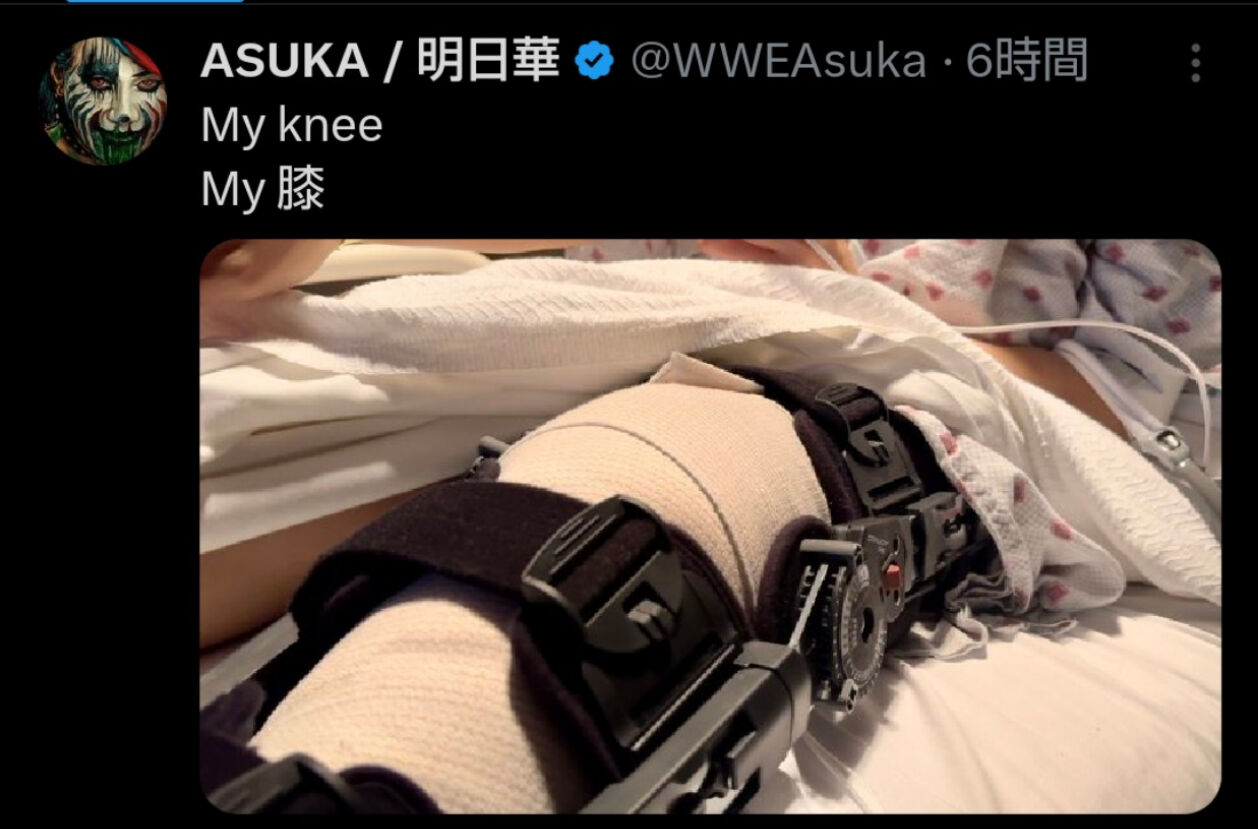膝の治療をSNSを通じて報告するWWEのアスカ（アスカ公式Xから）