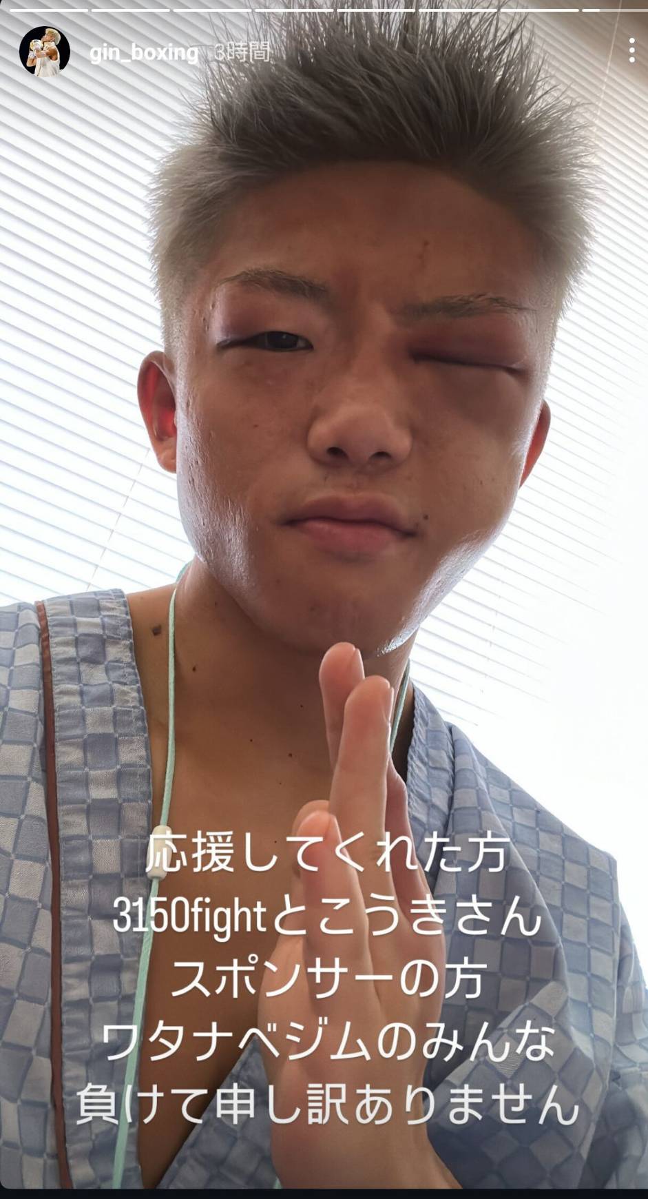 プロキャリア初黒星後、腫れ上がった顔をSNSで更新した前IBF世界ミニマム級王者重岡銀次朗（重岡のインスタグラムから）