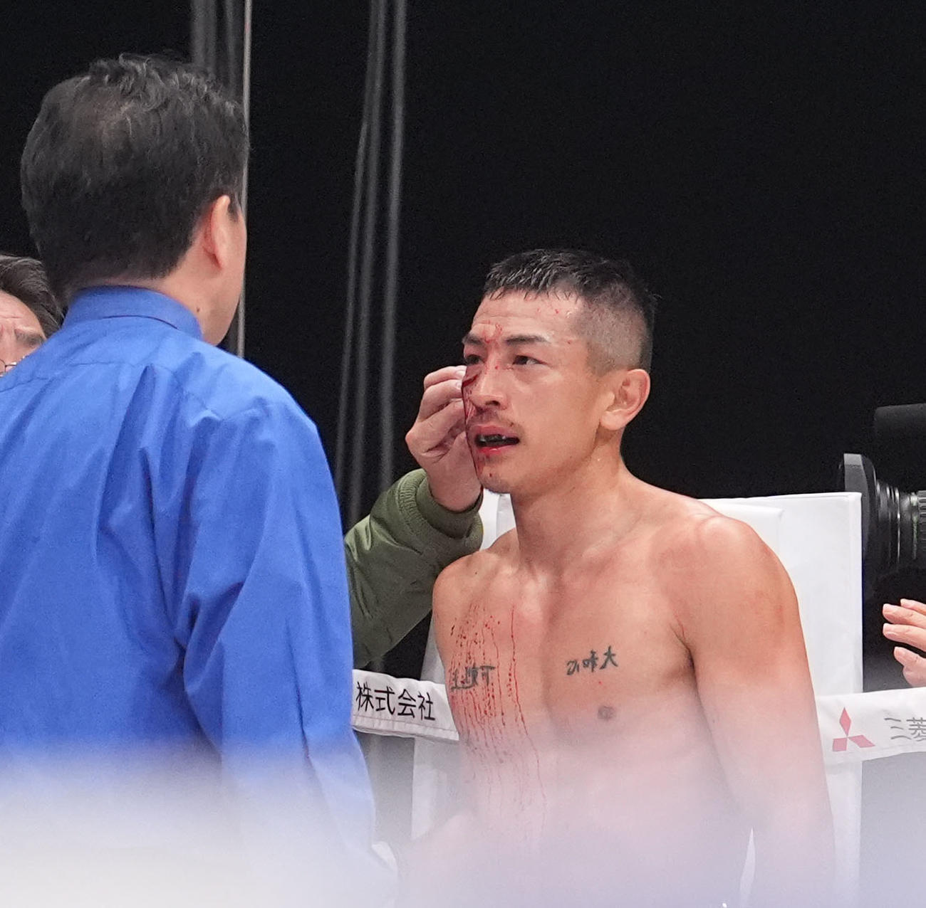 3回、アヤラとバッティングで出血する矢吹（右）（撮影・森本幸一）