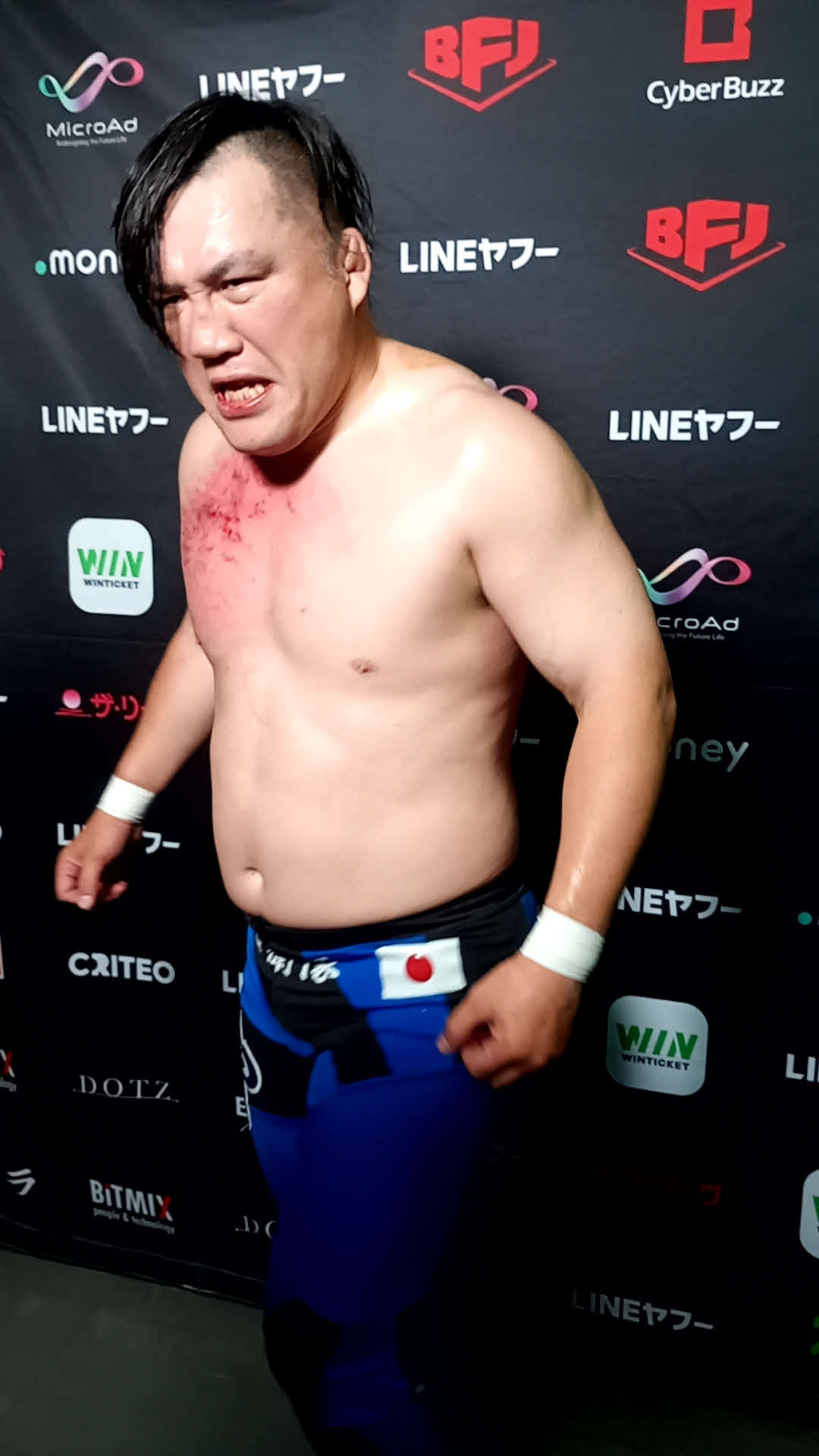 丸藤正道の逆水平で胸から出血した佐藤光留は「全然痛くありませんでした」