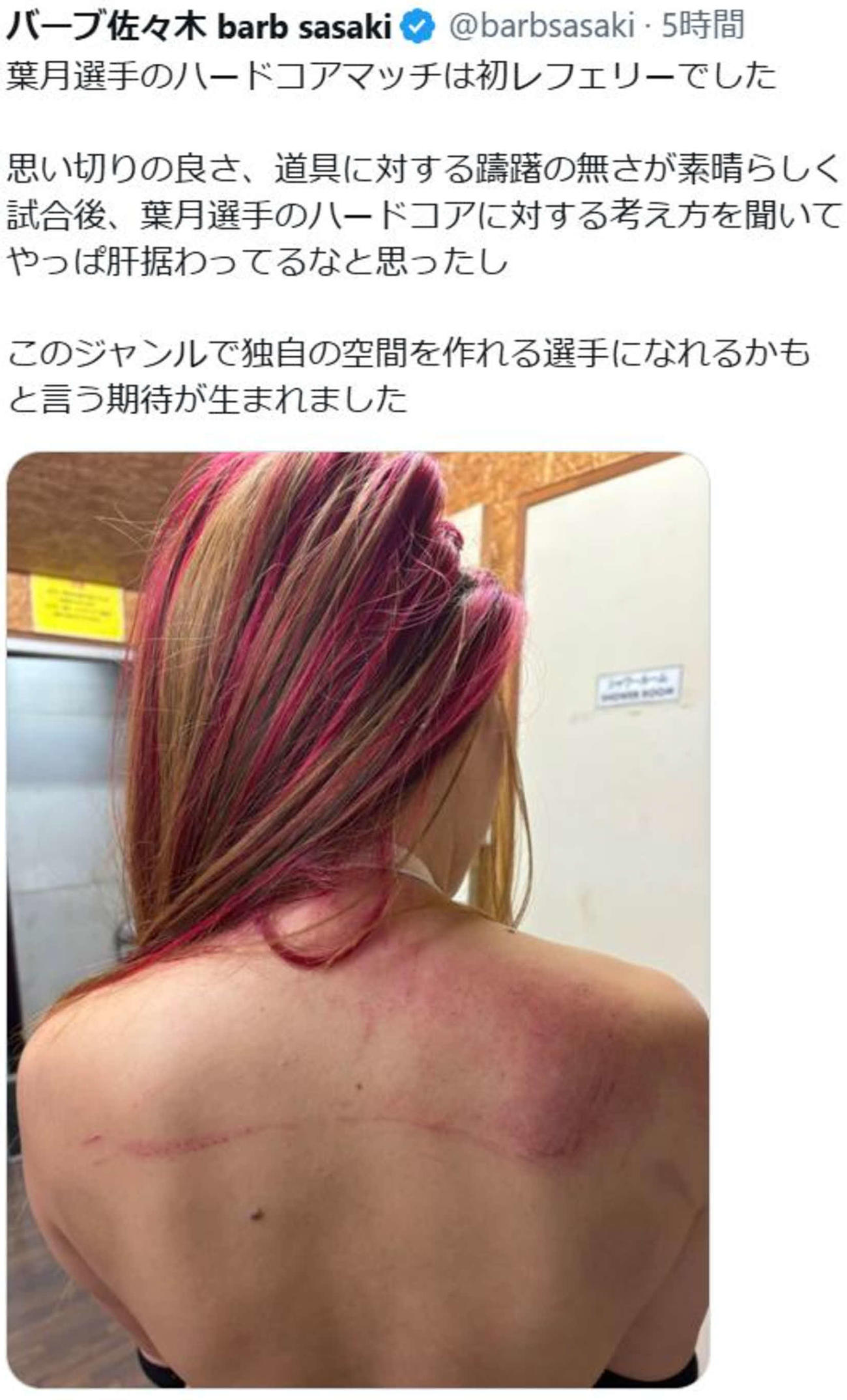 バーブ佐々木レフェリーが赤く腫れた葉月の背中の写真をXに投稿した