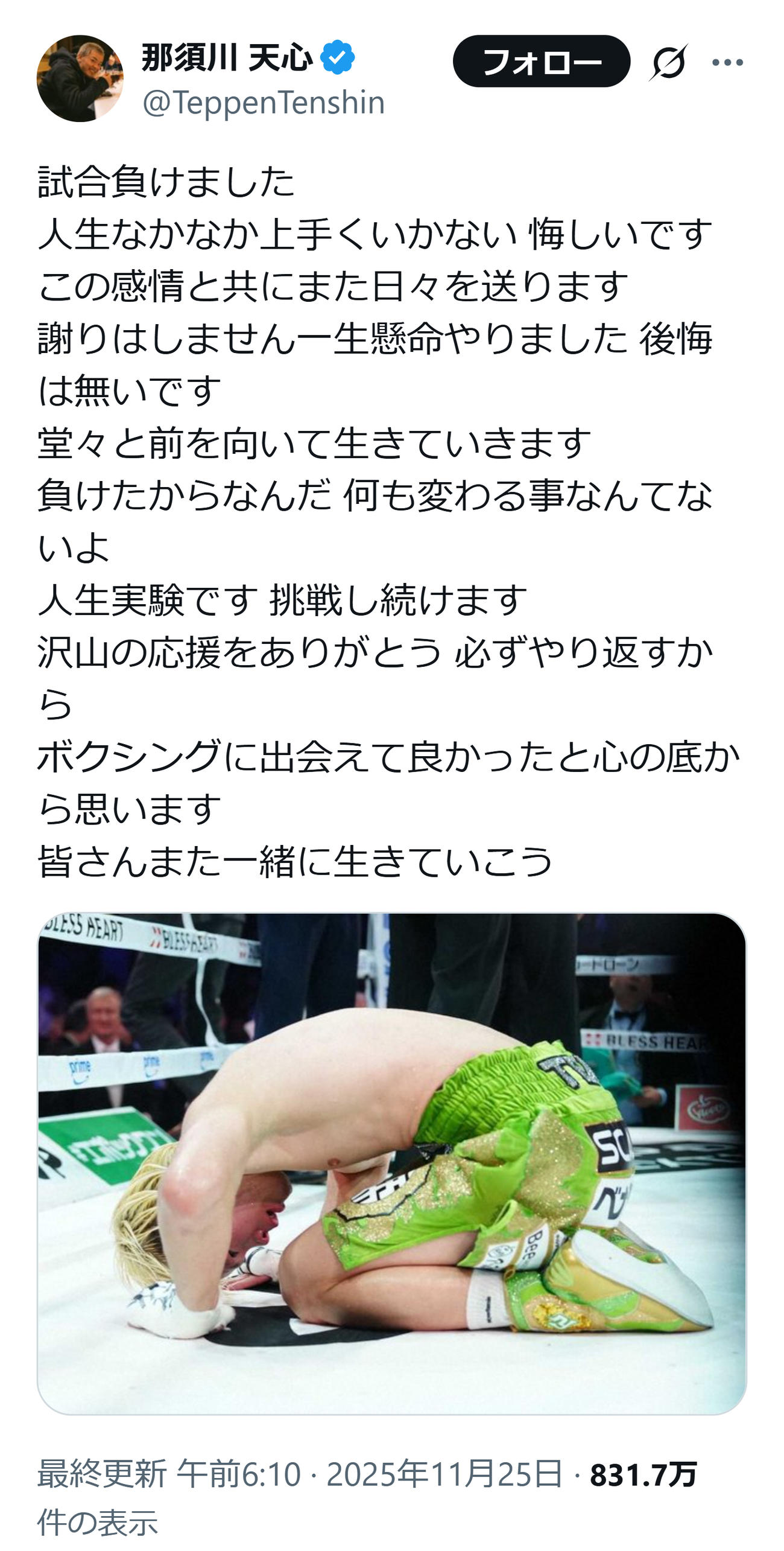 初黒星から一夜明け再起を誓った那須川天心（那須川天心のXから）