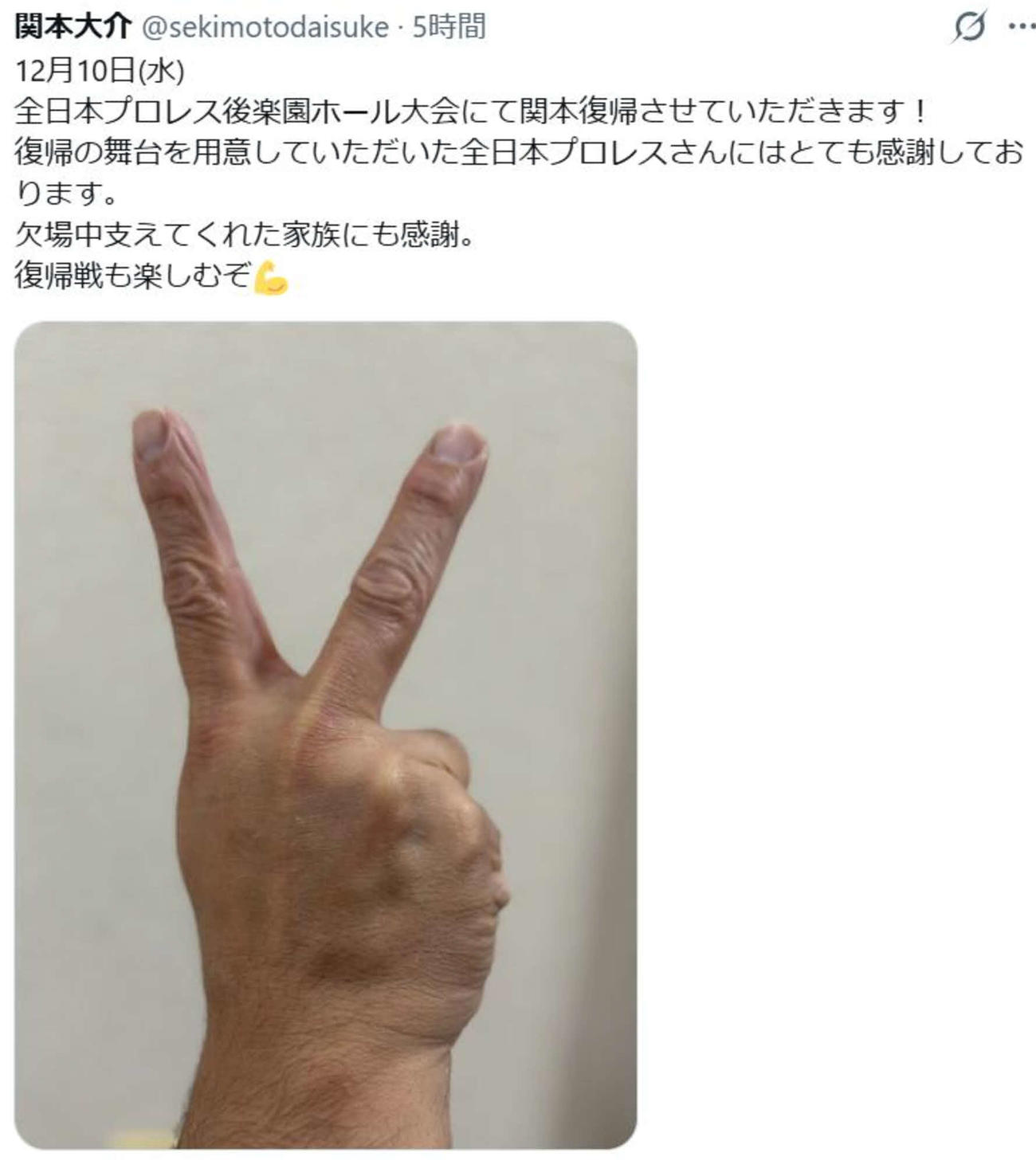 関本大介はXでケガからの復帰を明かした