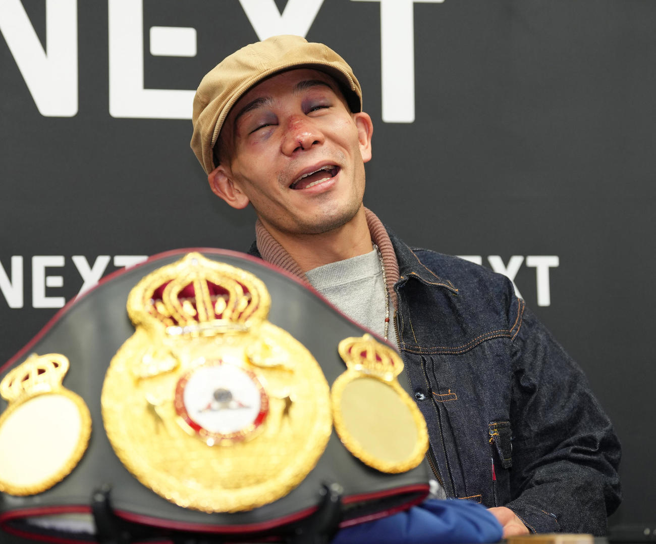 一夜明け会見中、笑顔を見せながら痛がる堤（撮影・足立雅史）