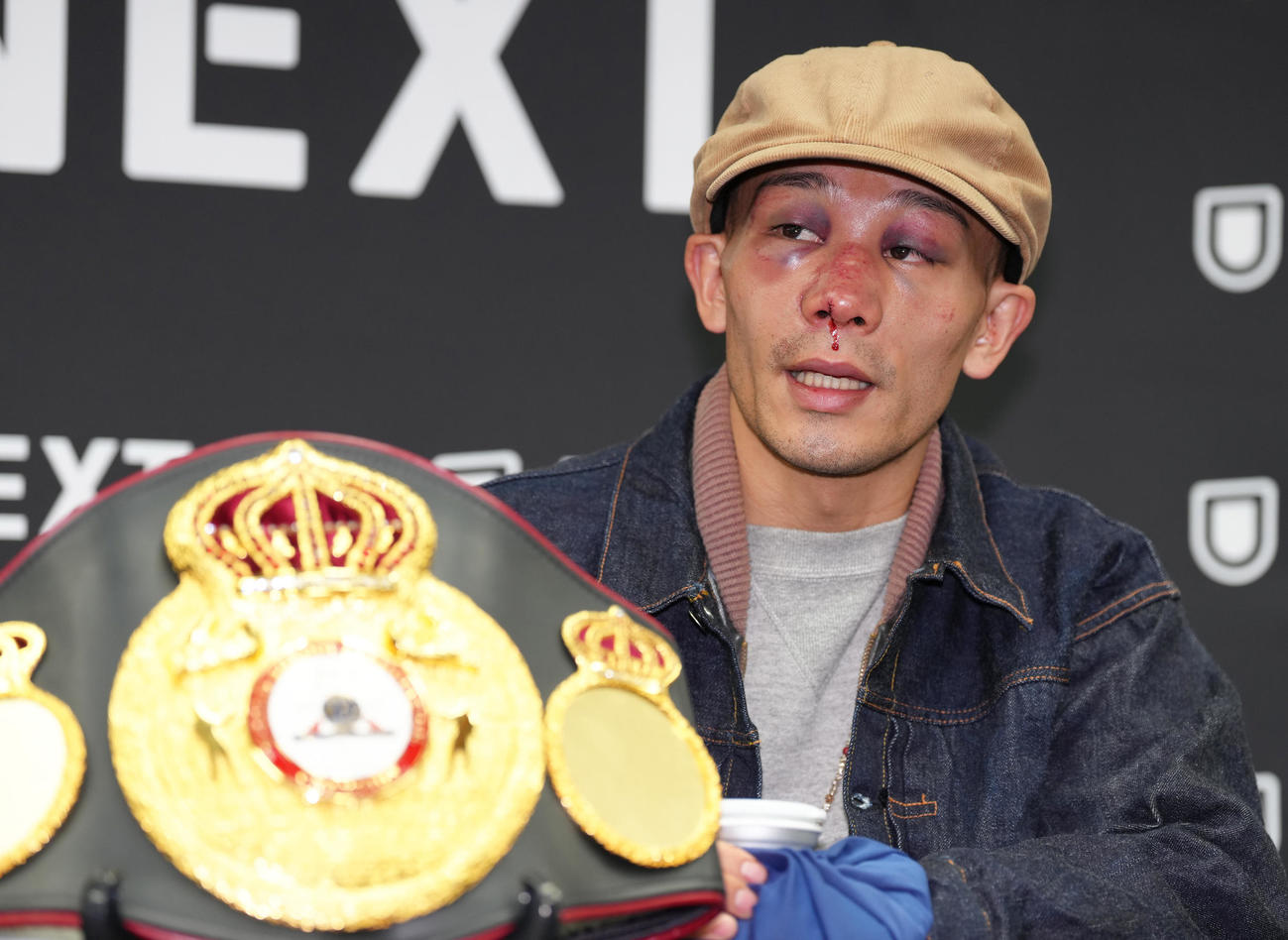一夜明け、会見に臨んだ堤は負傷した鼻から血が垂れる（撮影・足立雅史）