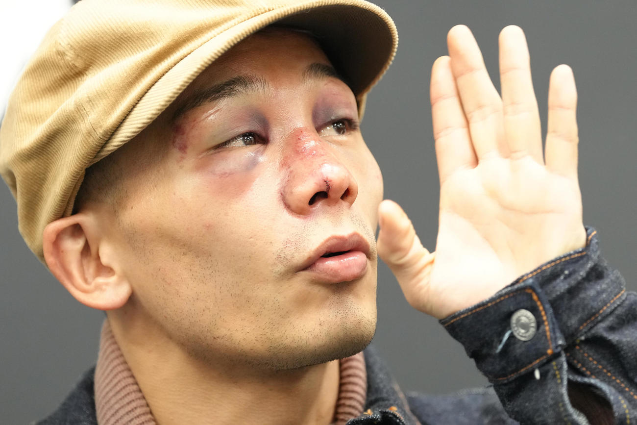 一夜明け、痛々しい顔で試合を振り返る堤（撮影・足立雅史）
