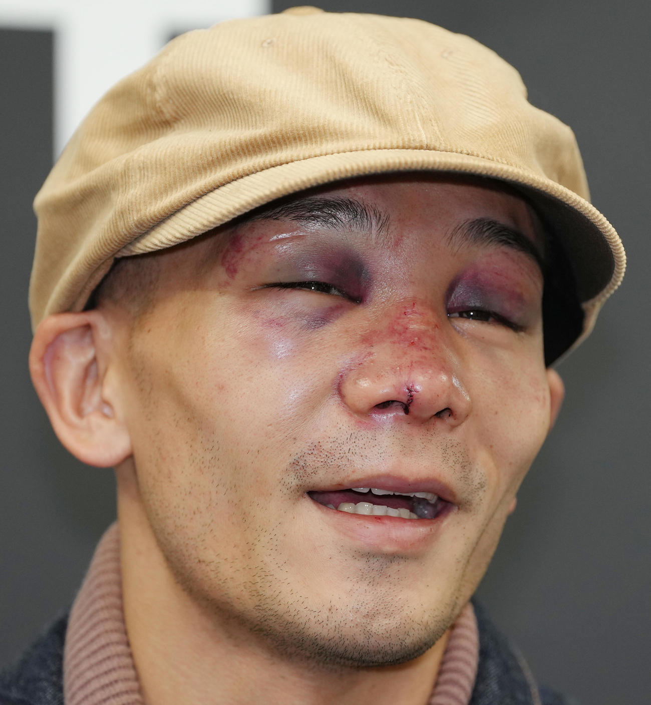 一夜明け、痛々しい顔で試合を振り返る堤（撮影・足立雅史）
