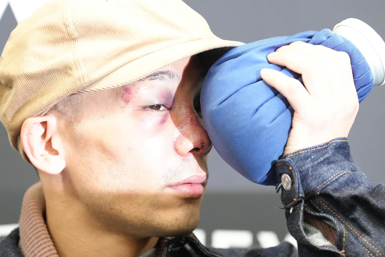 一夜明け、氷のうで顔を冷やしながら会見に臨む堤（撮影・足立雅史）