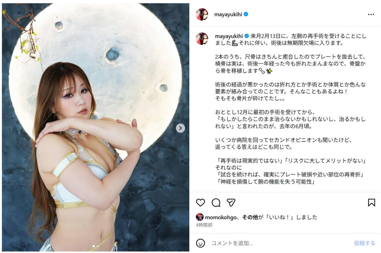 インスタグラムで再手術することを発表した雪妃真矢