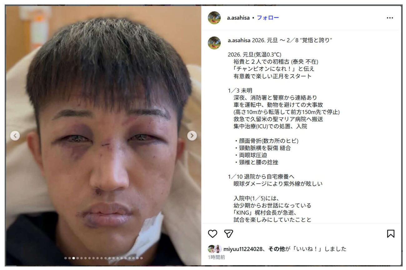 朝久裕貴が正月に車で事故に遭い、大けがを負っていたことを父の朝久篤さんがインスタグラムで明かした